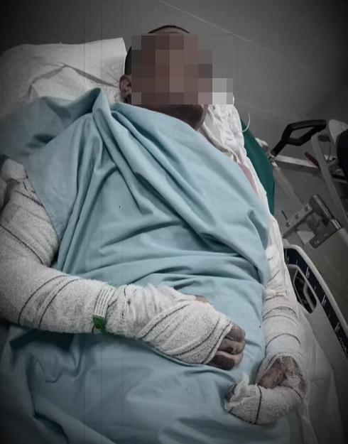 🆘【金边朗哥区纵火案后续：受害中国男…-manila58.com